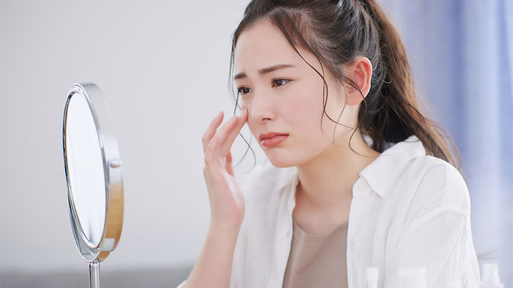 ニキビに悩む女性