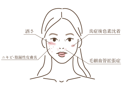 赤ら顔